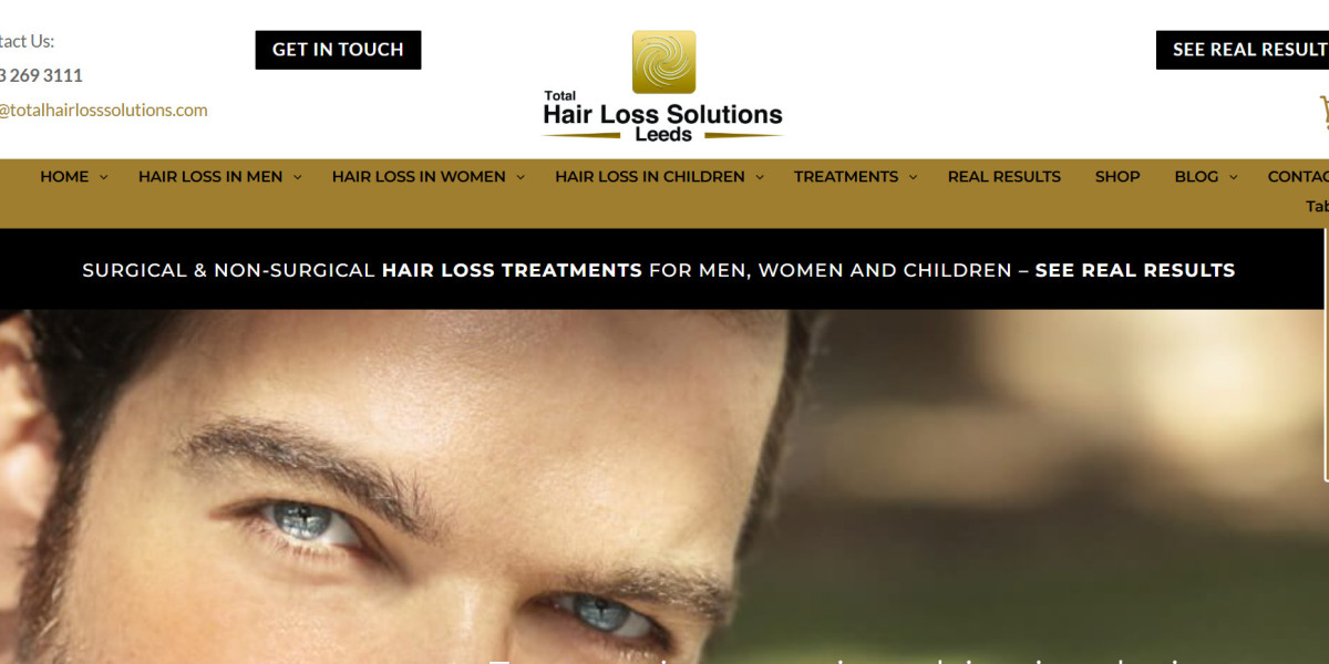 Hair Loss Treatment for Men Near Me – Regain Your Confidence