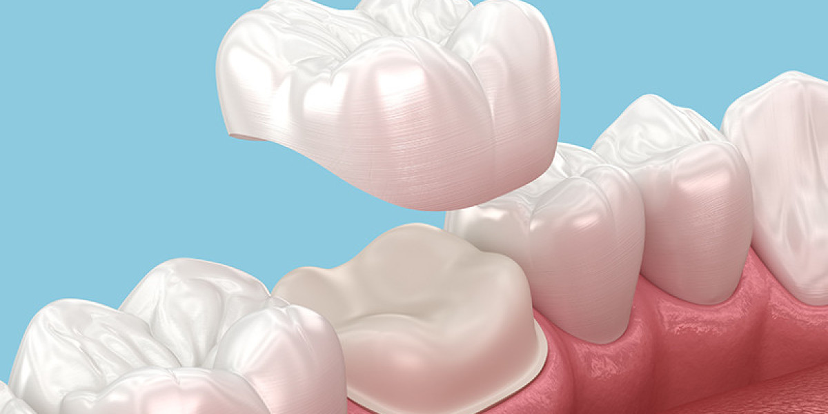 Dental Crowns and Bridges Dubai – Restore Strength and Beauty to Your Teeth