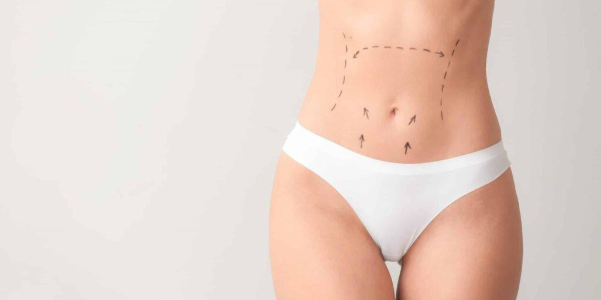 Benefits of Abdominoplasty in Dubai Beyond Aesthetic Results