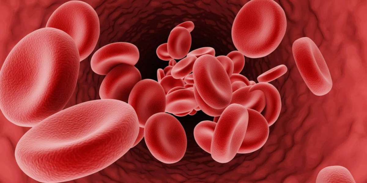 High Cholesterolemia in Dubai: How It Affects Long-Term Health