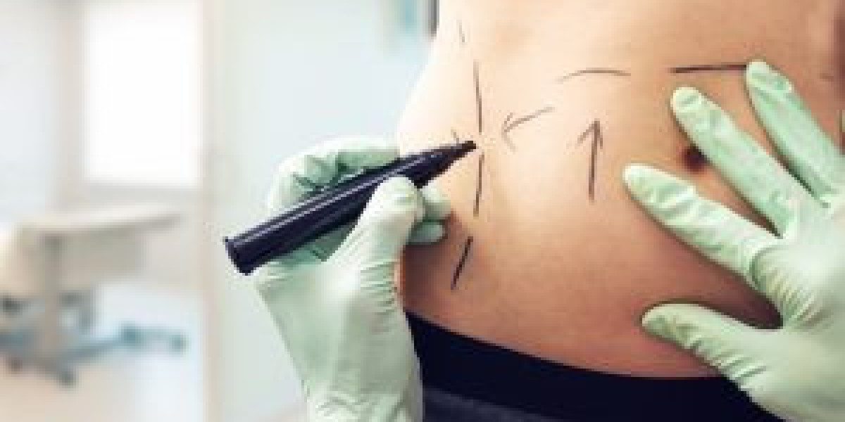Before and After: Stunning Tummy Tuck Transformations in Dubai