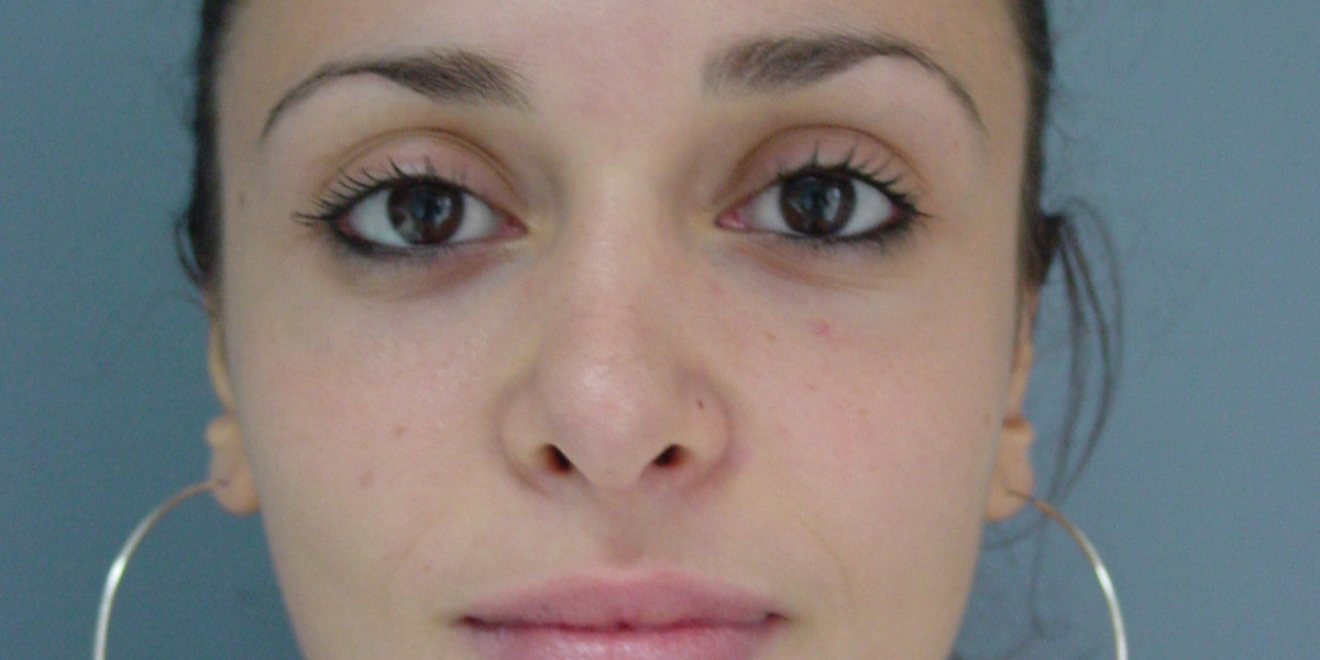 Plastic Surgery in Abu Dhabi Mediclinic Airport Road Hospital